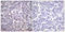 B-Raf Proto-Oncogene, Serine/Threonine Kinase antibody, LS-C117802, Lifespan Biosciences, Immunohistochemistry frozen image 