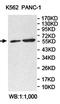 Activin A Receptor Type 2B antibody, orb78278, Biorbyt, Western Blot image 