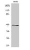 G Protein Regulated Inducer Of Neurite Outgrowth 2 antibody, STJ93425, St John