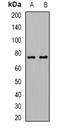 Arachidonate 15-Lipoxygenase Type B antibody, LS-B14585, Lifespan Biosciences, Western Blot image 