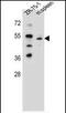 T-box transcription factor TBX6 antibody, PA5-35102, Invitrogen Antibodies, Western Blot image 