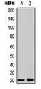 Coatomer Protein Complex Subunit Zeta 1 antibody, LS-C358950, Lifespan Biosciences, Western Blot image 