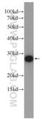 Casein Kinase 2 Beta antibody, 22418-1-AP, Proteintech Group, Western Blot image 