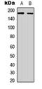 Ret Proto-Oncogene antibody, LS-C358278, Lifespan Biosciences, Western Blot image 