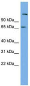 Chromosome 12 Open Reading Frame 4 antibody, TA344789, Origene, Western Blot image 