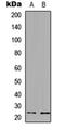 Ubiquitin Conjugating Enzyme E2 E3 antibody, orb234976, Biorbyt, Western Blot image 
