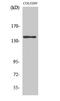 Adenylate Cyclase 5 antibody, STJ91397, St John