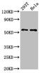 Erythropoietin Receptor antibody, LS-C670134, Lifespan Biosciences, Western Blot image 