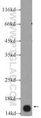 Ubiquitin-conjugating enzyme E2 B antibody, 10733-1-AP, Proteintech Group, Western Blot image 