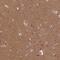 ER Membrane Associated RNA Degradation antibody, NBP1-90580, Novus Biologicals, Immunohistochemistry paraffin image 