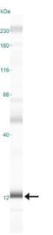 Mitogen-activated protein kinase scaffold protein 1 antibody, NBP1-50631, Novus Biologicals, Western Blot image 