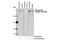 Inositol 1,4,5-Trisphosphate Receptor Type 1 antibody, 8548S, Cell Signaling Technology, Western Blot image 