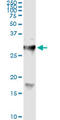 Hyaluronidase 1 antibody, LS-C197478, Lifespan Biosciences, Immunoprecipitation image 