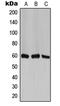 Chaperonin Containing TCP1 Subunit 6A antibody, LS-C351939, Lifespan Biosciences, Western Blot image 