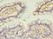 Calmodulin Like 4 antibody, A51077-100, Epigentek, Immunohistochemistry paraffin image 