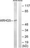 Rho Guanine Nucleotide Exchange Factor 5 antibody, LS-C120333, Lifespan Biosciences, Western Blot image 