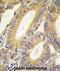 X-Linked Inhibitor Of Apoptosis antibody, abx032692, Abbexa, Immunohistochemistry paraffin image 