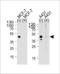 Calcitonin Receptor antibody, 62-008, ProSci, Western Blot image 