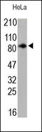 Protein Kinase C Alpha antibody, 251886, Abbiotec, Western Blot image 