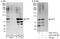 CXXC Finger Protein 1 antibody, A303-161A, Bethyl Labs, Western Blot image 