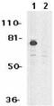 Metastasis Associated 1 Family Member 2 antibody, ab8106, Abcam, Western Blot image 