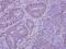 Histone Deacetylase 7 antibody, NBP2-16795, Novus Biologicals, Immunohistochemistry frozen image 
