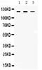 Class II Major Histocompatibility Complex Transactivator antibody, PB9996, Boster Biological Technology, Western Blot image 