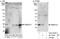 Transmembrane protein 127 antibody, A303-450A, Bethyl Labs, Immunoprecipitation image 