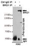 SWI/SNF Related, Matrix Associated, Actin Dependent Regulator Of Chromatin, Subfamily A, Member 4 antibody, STJ99058, St John