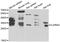 Interleukin 22 Receptor Subunit Alpha 2 antibody, 22-737, ProSci, Western Blot image 