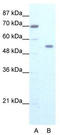 Zinc Finger Protein 665 antibody, TA341396, Origene, Western Blot image 