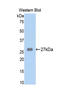 Alpha-2-macroglobulin antibody, LS-C302811, Lifespan Biosciences, Western Blot image 