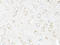 Microtubule Associated Protein 1 Light Chain 3 Beta antibody, LS-C750554, Lifespan Biosciences, Immunohistochemistry paraffin image 