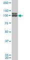 DEAD-Box Helicase 54 antibody, H00079039-M02, Novus Biologicals, Western Blot image 