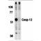 Caspase-12 antibody, MBS150406, MyBioSource, Western Blot image 