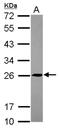 Transmembrane P24 Trafficking Protein 5 antibody, NBP2-20662, Novus Biologicals, Western Blot image 