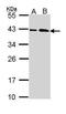 SUMO1 Activating Enzyme Subunit 1 antibody, PA5-22297, Invitrogen Antibodies, Western Blot image 