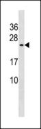 CutA Divalent Cation Tolerance Homolog antibody, LS-C203860, Lifespan Biosciences, Western Blot image 