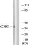 Potassium Two Pore Domain Channel Subfamily K Member 1 antibody, LS-C120229, Lifespan Biosciences, Western Blot image 