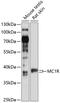 Melanocortin 1 Receptor antibody, 15-034, ProSci, Western Blot image 
