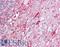 Autophagy Related 9A antibody, LS-B6984, Lifespan Biosciences, Immunohistochemistry frozen image 