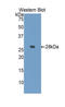 Insulin Like Growth Factor Binding Protein 4 antibody, LS-C294658, Lifespan Biosciences, Western Blot image 