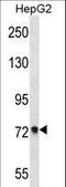 Acyl-CoA Synthetase Short Chain Family Member 2 antibody, LS-B15656, Lifespan Biosciences, Western Blot image 