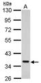 SEC61 Translocon Alpha 1 Subunit antibody, LS-C185813, Lifespan Biosciences, Western Blot image 