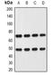 Carcinoembryonic Antigen Related Cell Adhesion Molecule 1 antibody, orb377988, Biorbyt, Western Blot image 