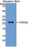 Troponin I1, Slow Skeletal Type antibody, LS-C296812, Lifespan Biosciences, Western Blot image 