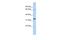 Grainyhead Like Transcription Factor 2 antibody, PA5-41639, Invitrogen Antibodies, Western Blot image 