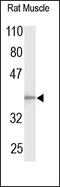 Gap Junction Protein Alpha 1 antibody, 251847, Abbiotec, Western Blot image 