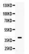 Adenosine Kinase antibody, PB10031, Boster Biological Technology, Western Blot image 