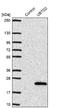 Ubiquitin Domain Containing 2 antibody, NBP1-85276, Novus Biologicals, Western Blot image 